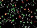 Нервные клетки, зараженные вирусом Зика © NIH Image Gallery/Flickr