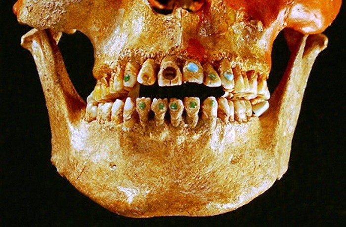 Древняя инкрустация зубов