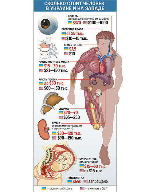 Занимательная инфографика по Украине медицина, органы, транспланталогия
