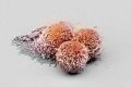 Раковые клети © University of Basel, Biozentrum/Swiss Nanoscience Institute)