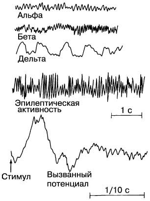 ЭЛЕКТРИЧЕСКАЯ АКТИВНОСТЬ мозга регистрируется с помощью электроэнцефалографа. Получаемые кривые – электроэнцефалограммы (ЭЭГ) – могут указывать на расслабленное бодрствование (альфа-волны), активное бодрствование (бета-волны), сон (дельта-волны), эпилепсию или реакцию на определенные стимулы (вызванные потенциалы).