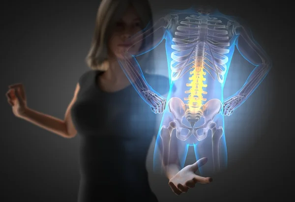 Женщина и голограммой с рентгенография костей — стоковое фото